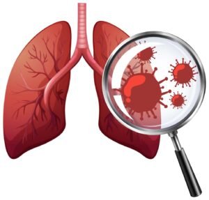Acute Bronchitis